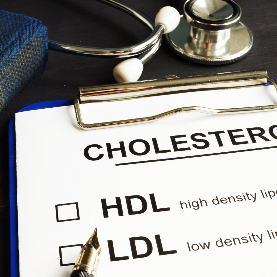 Lipid Testing