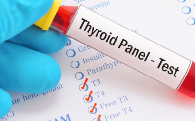 What you didn’t know about your Thyroid lab work