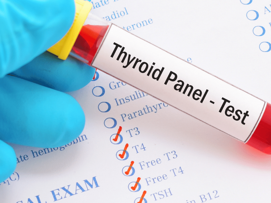 What you didn’t know about your Thyroid lab work