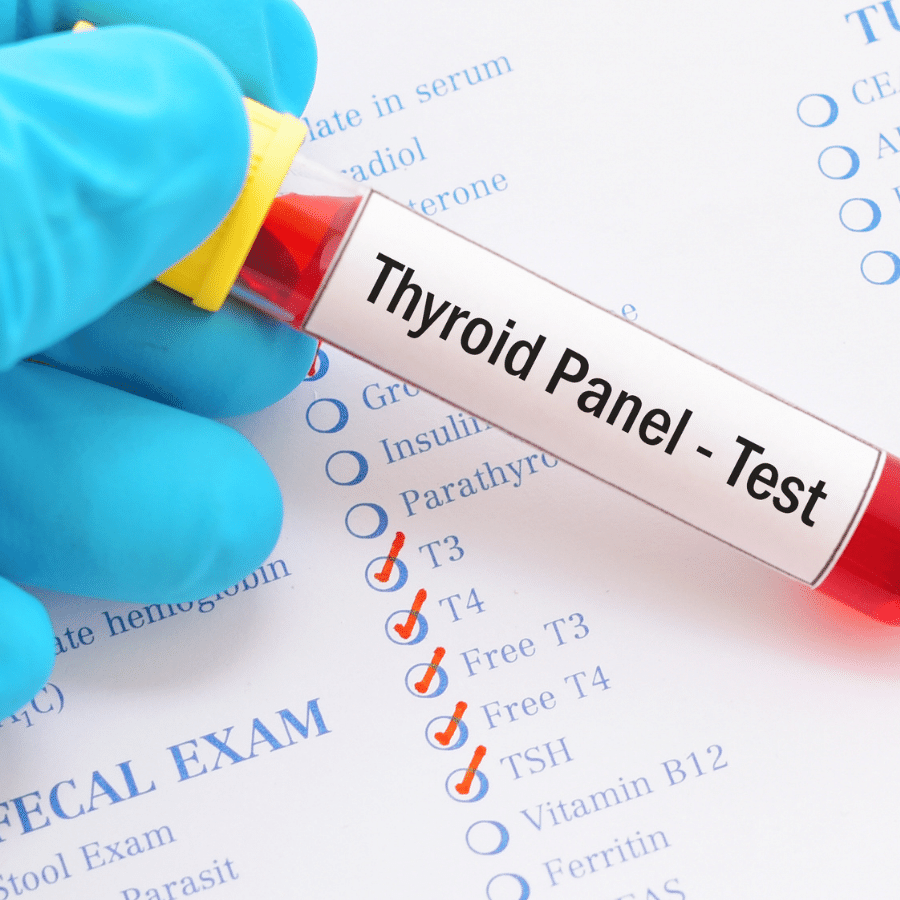 Thyroid Lab work